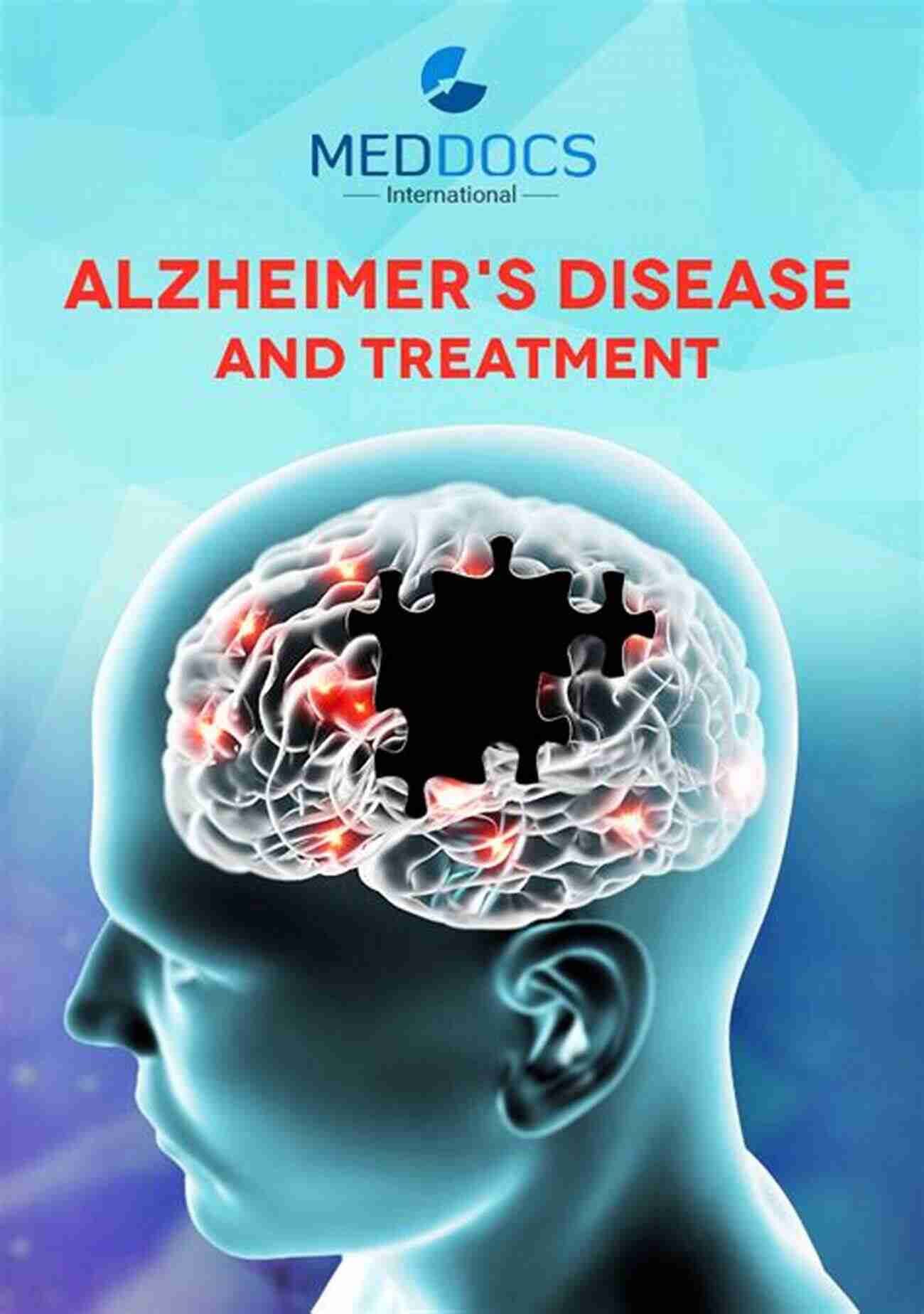 Exploring Groundbreaking Research On Alzheimer's Disease Treatment Using Medicinal Chemistry Alzheimer S Disease (Topics In Medicinal Chemistry 2)